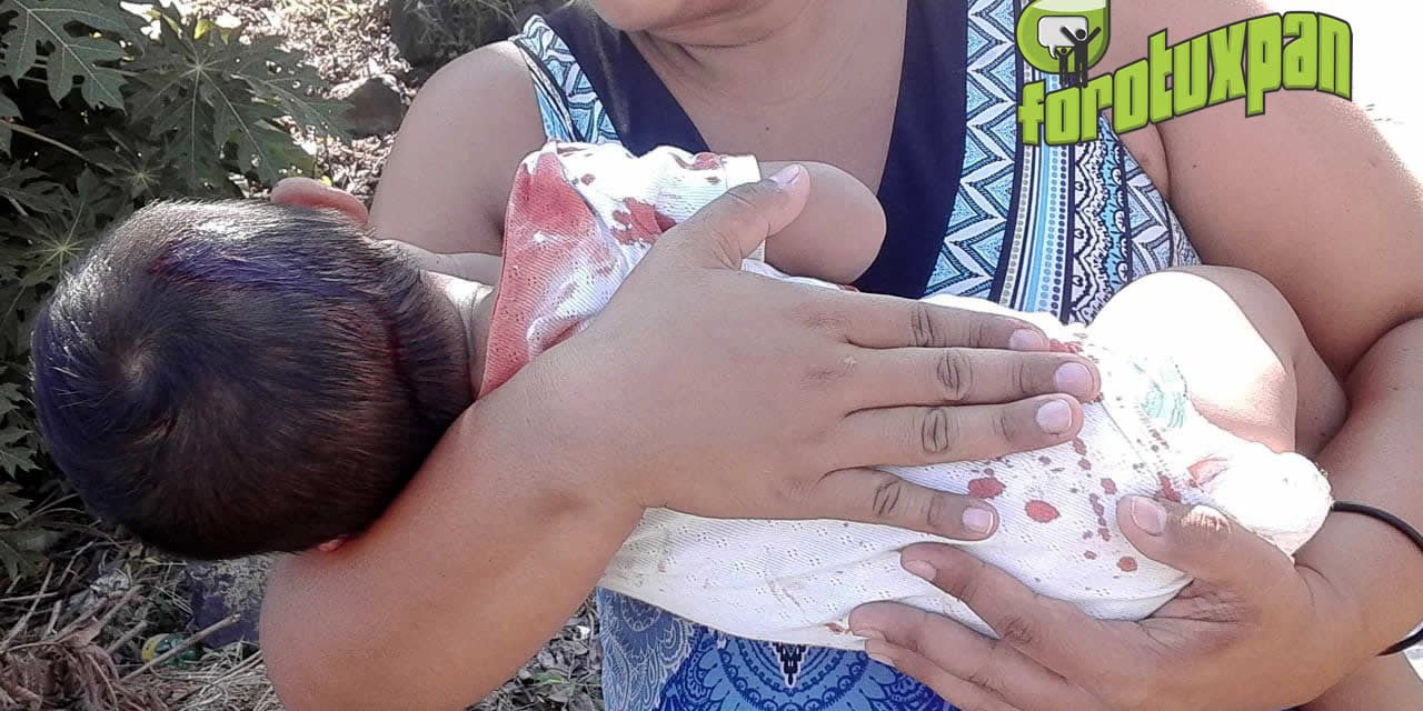 Bebé herido en accidente motociclístico